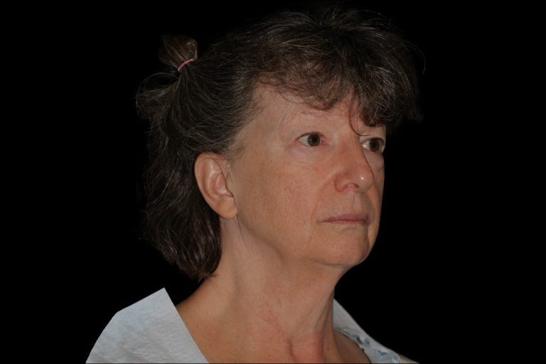 Right Side