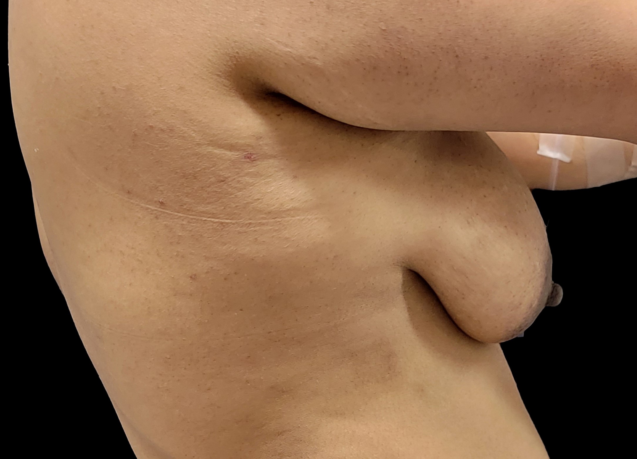 Left Profile