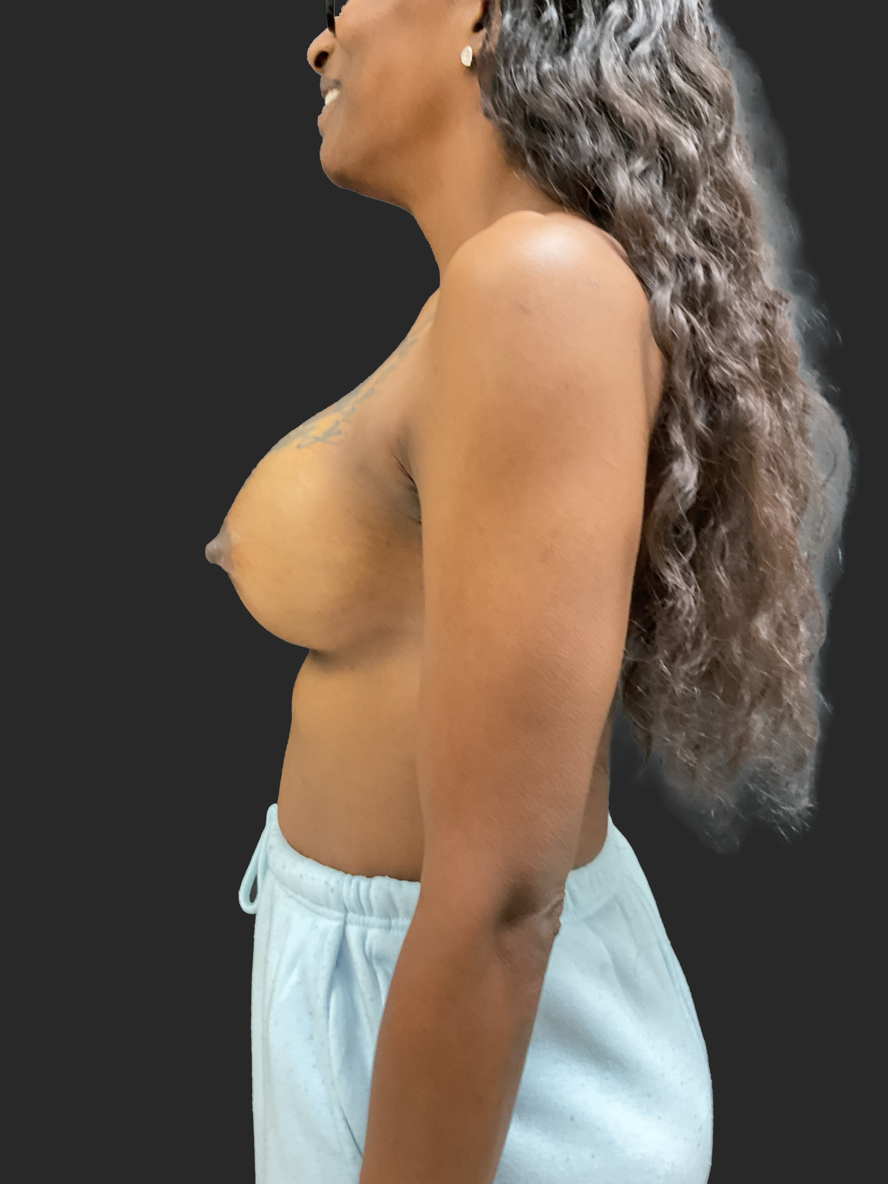 Side View