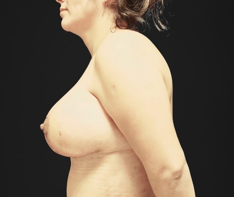 Left Profile
