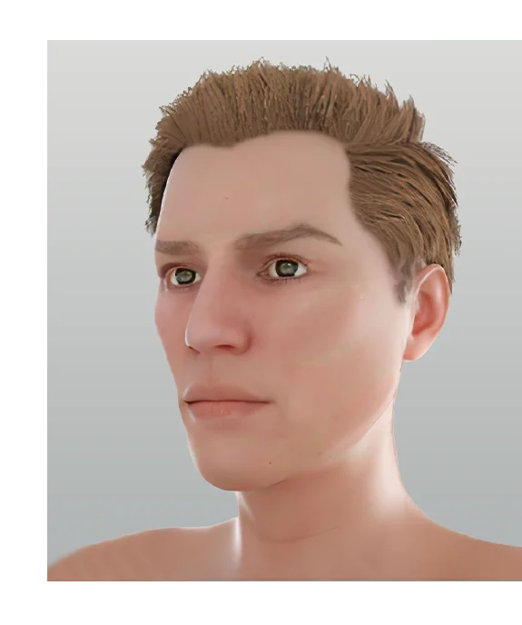 Before Transformation Face Profile