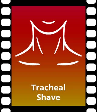 Tracheal Shave